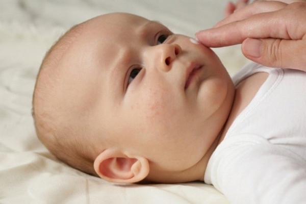 Аллергия у новорожденных: как проявляется и что делать