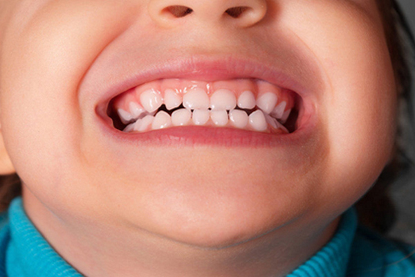 Бруксизм: почему ребенок скрипит зубами