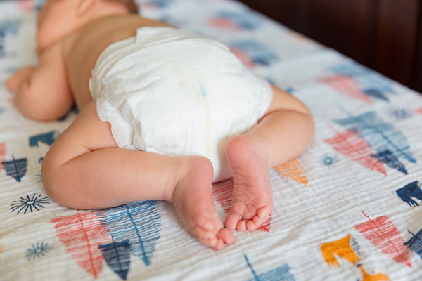 Опрелости у младенца: как ухаживать за кожей и чем лечить?