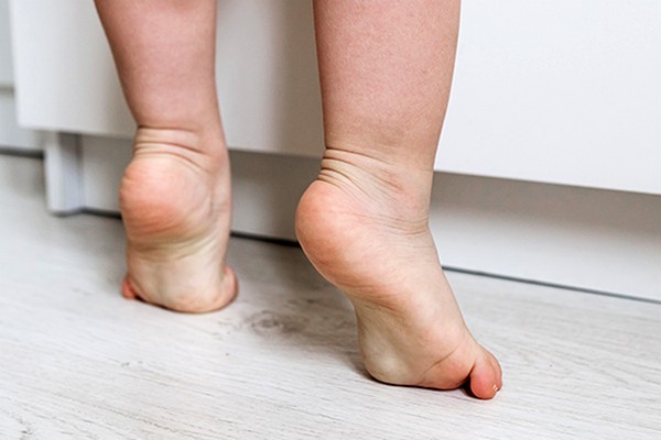 Малыш ходит на носочках: в чём опасность такой походки?
