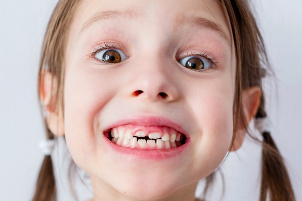 3 причины, из-за которых у ребенка могут раньше времени выпасть молочные зубы
